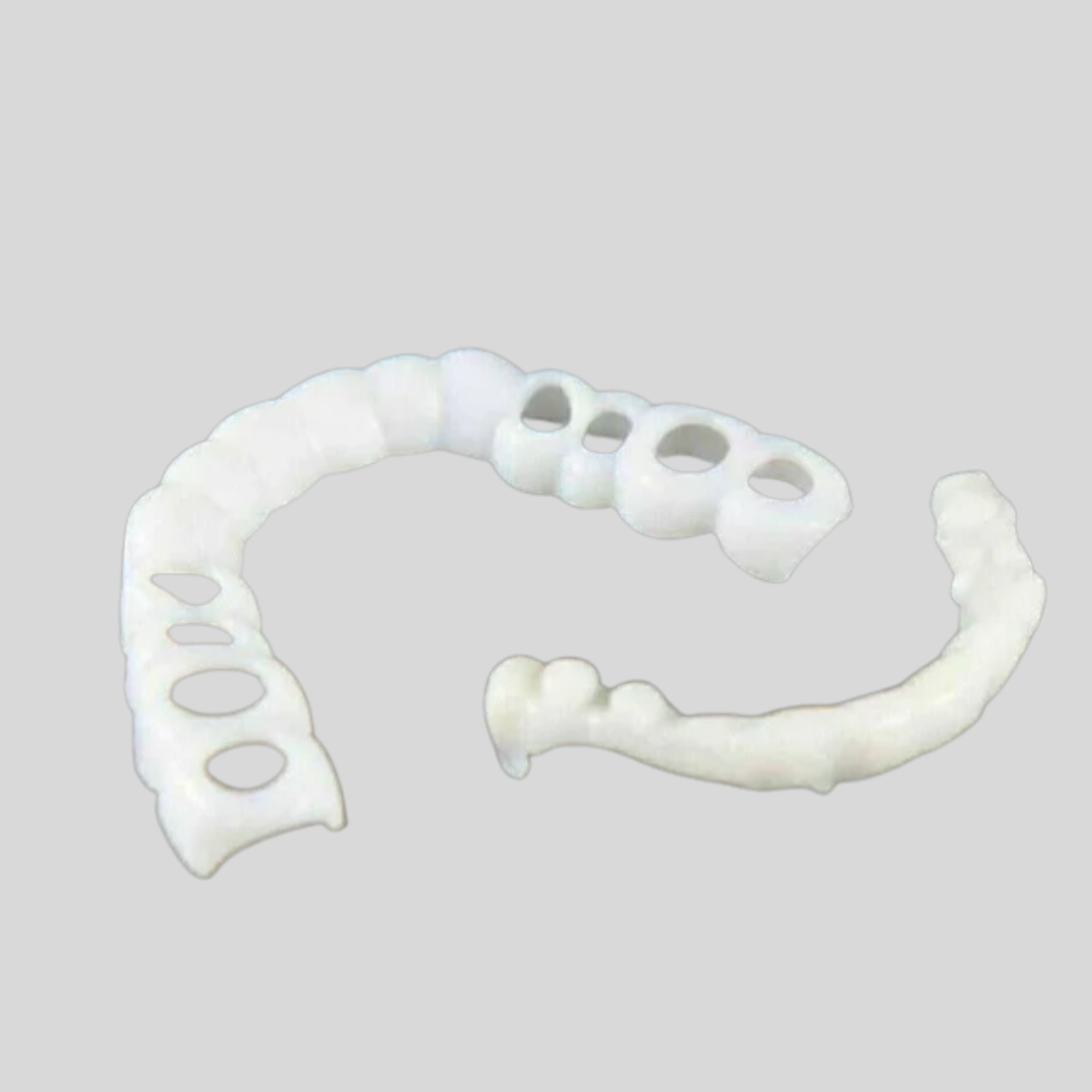 Faccette dentali ad incastro per migliorare il sorriso