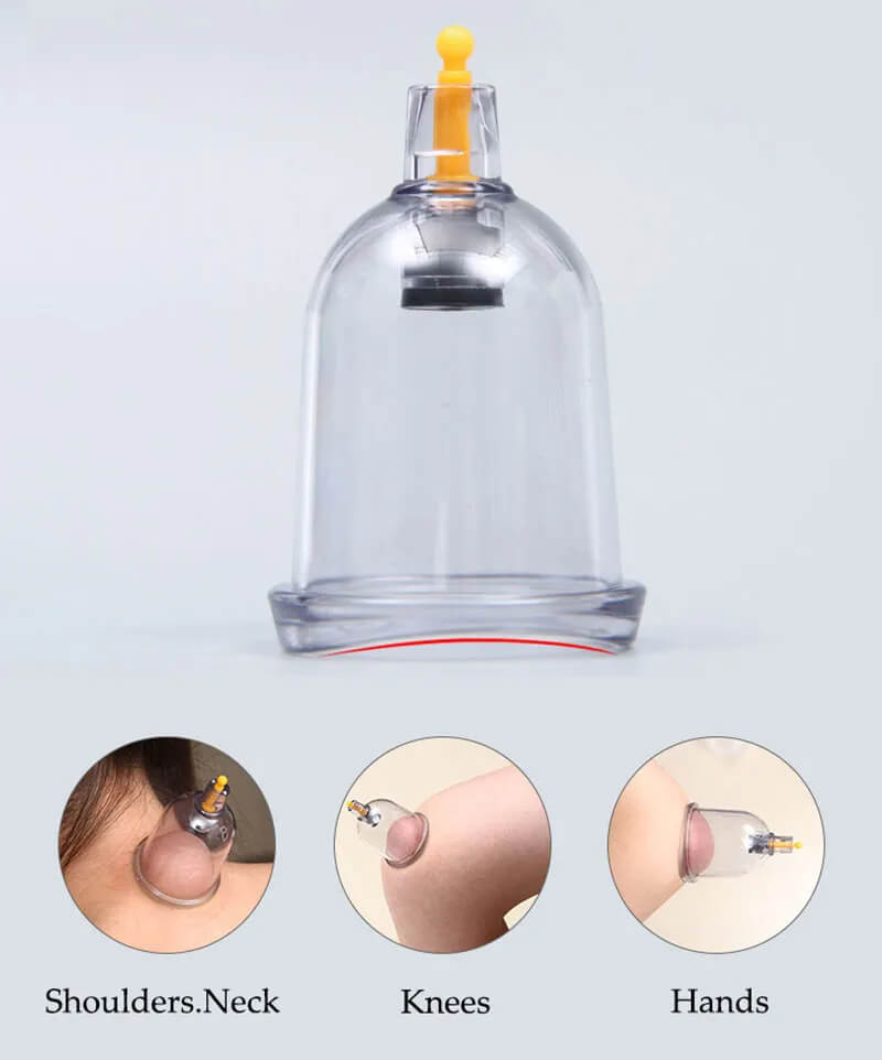 Set per coppettazione per la rigenerazione del corpo