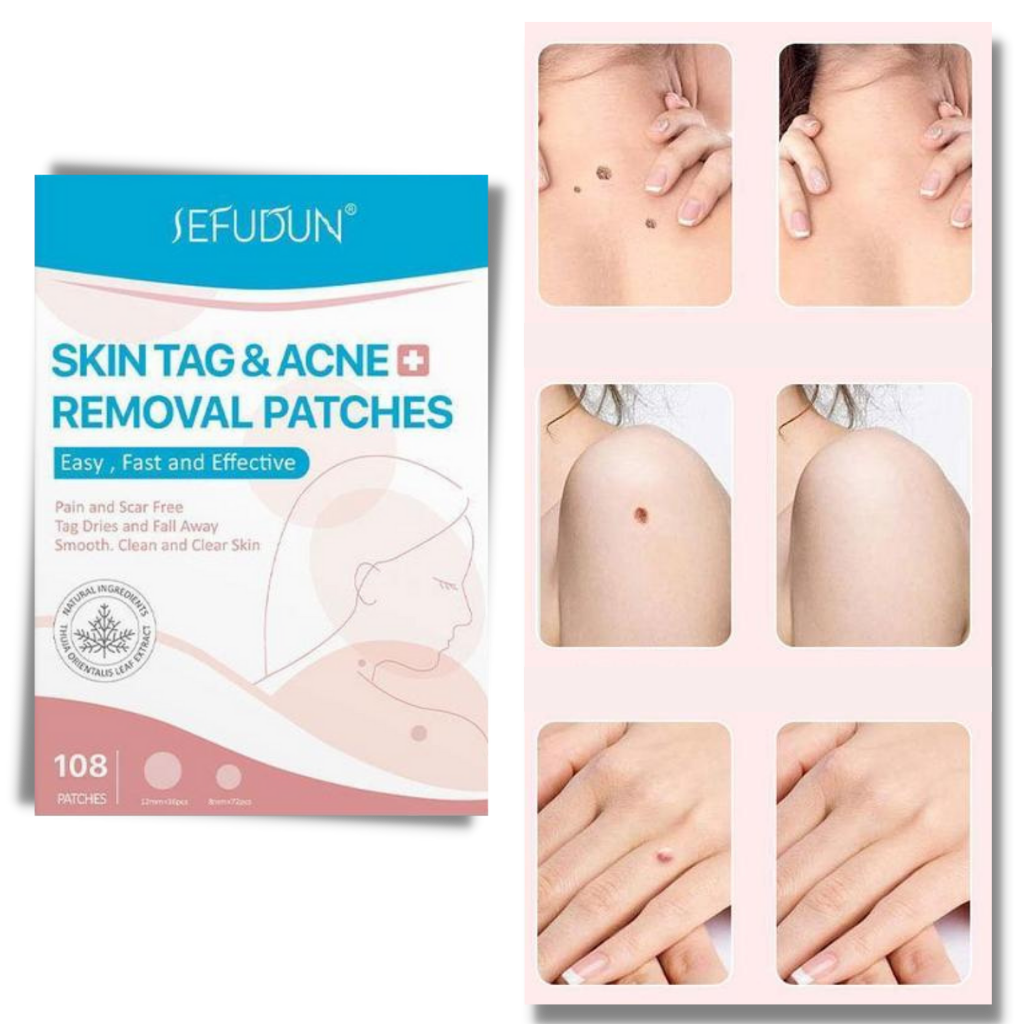 Cerotti per la pelle - Rimuovono fibromi penduli e porri in modo naturale!