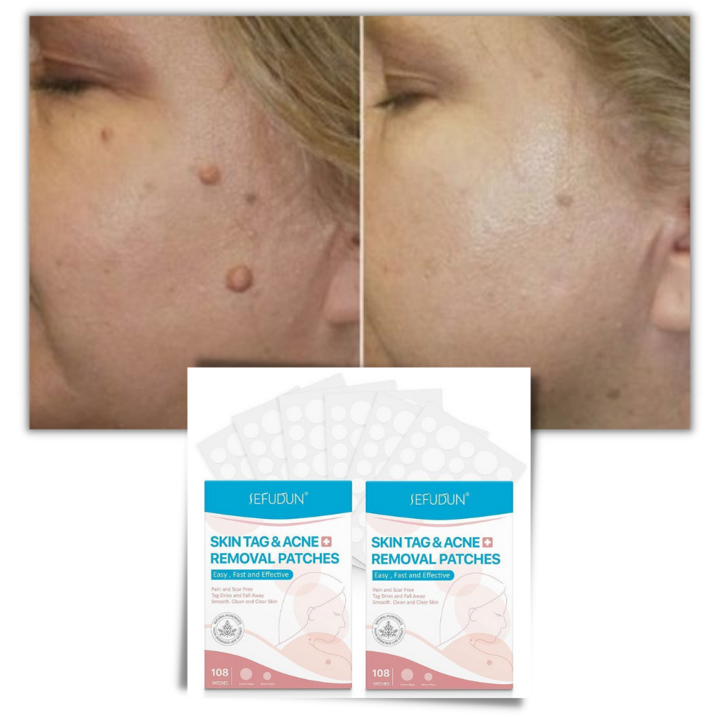 Cerotti per la pelle - Rimuovono fibromi penduli e porri in modo naturale!