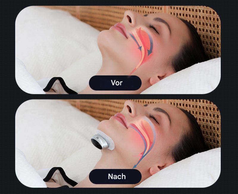Dispositivo per le Apnee Notturne
