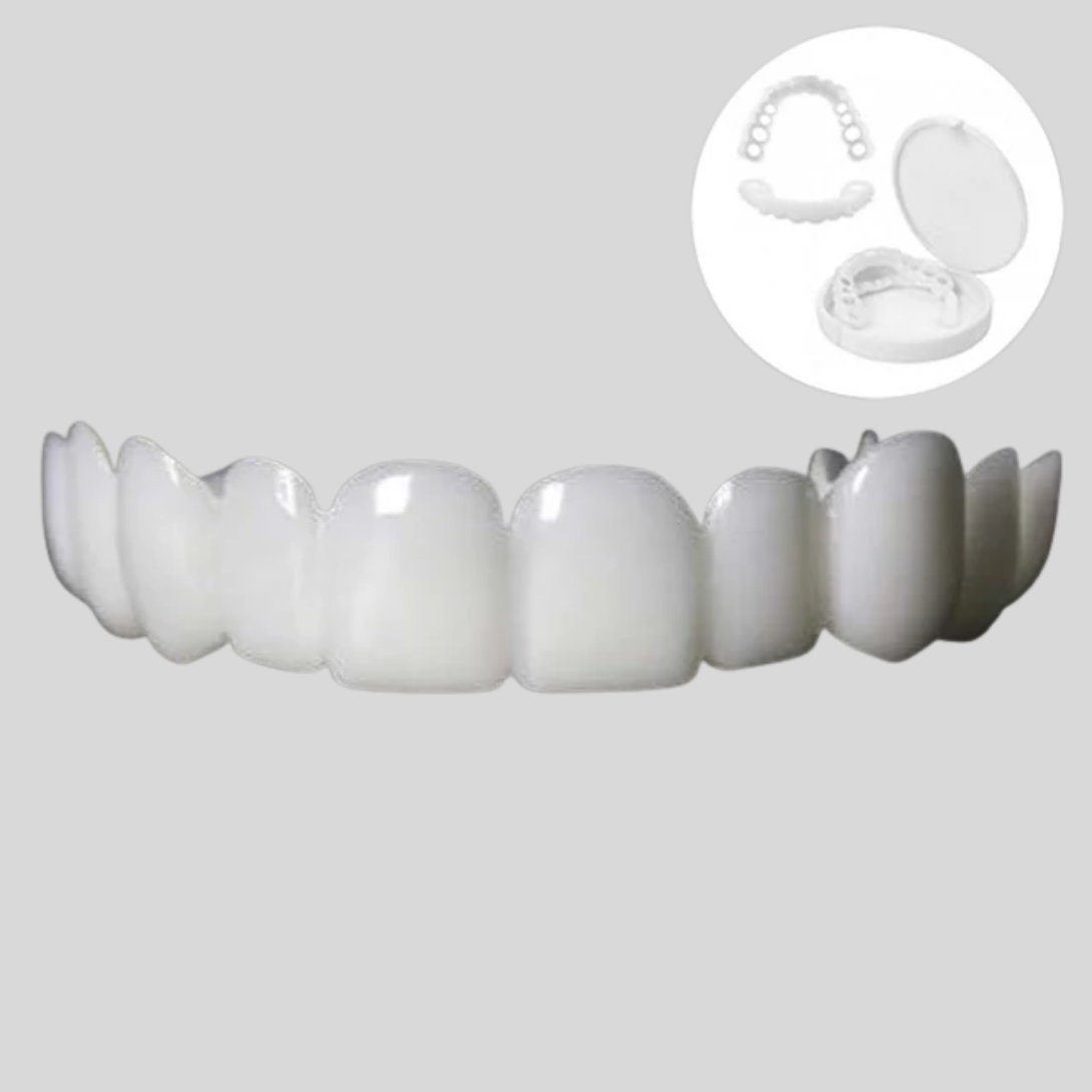 Faccette dentali ad incastro per migliorare il sorriso