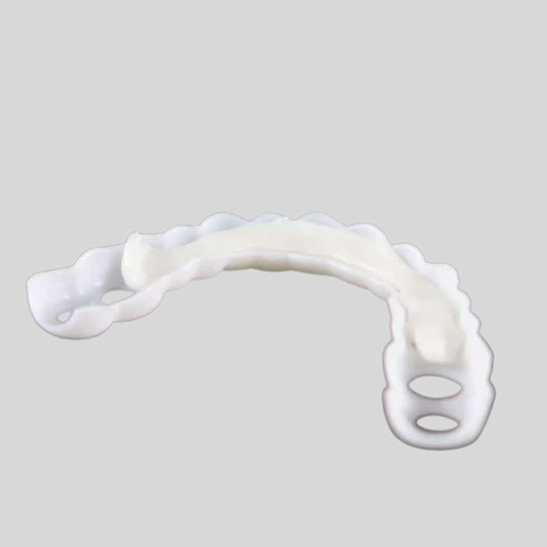 Faccette dentali ad incastro per migliorare il sorriso