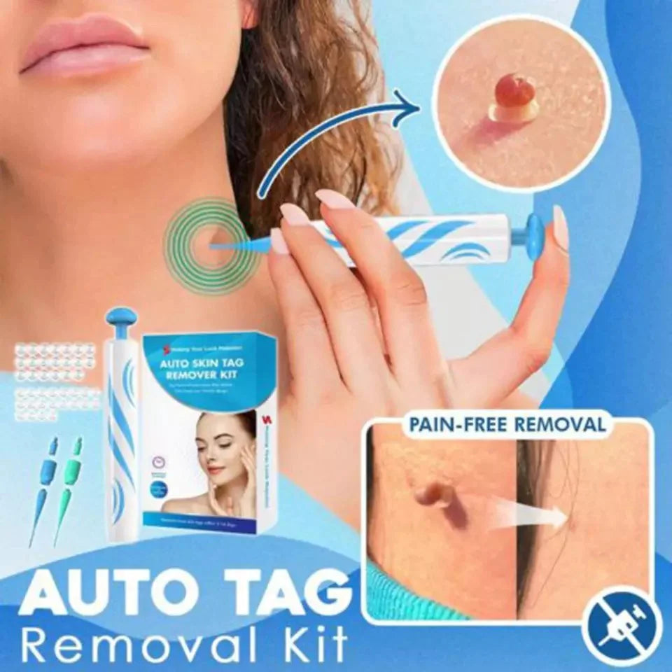 Kit con applicatore automatico di elastici per la rimozione di fibromi penduli