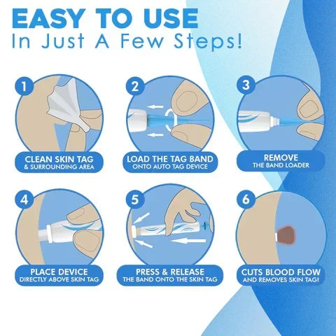 Kit con applicatore automatico di elastici per la rimozione di fibromi penduli