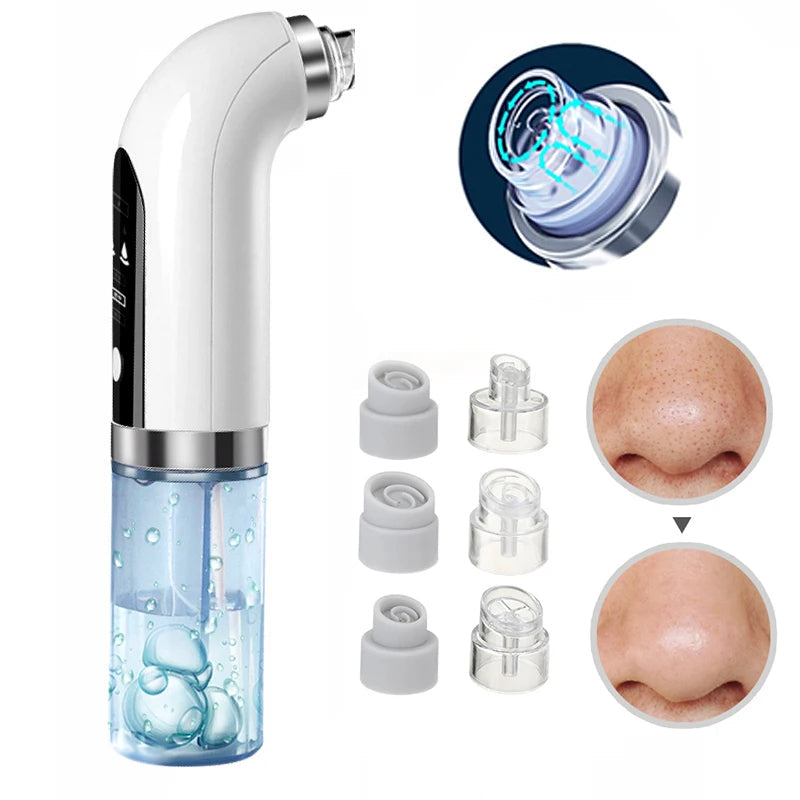 Punti neri del naso: aspiratore e pulitore sotto vuoto professionale per una pulizia profonda con tecnologia di aspirazione