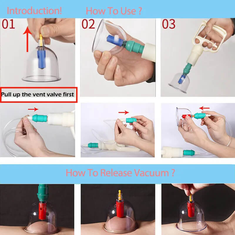 Set per coppettazione per la rigenerazione del corpo